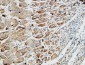 Somatostatin Polyclonal Antibody